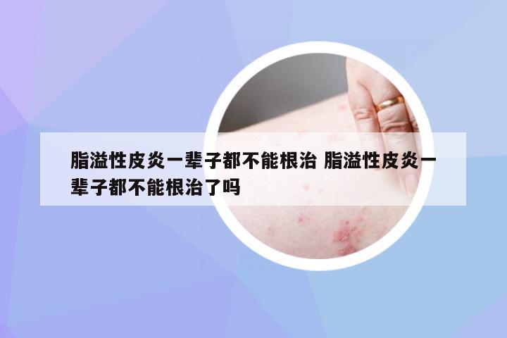 脂溢性皮炎，并非終身無法根治的疾病，脂溢性皮炎并非無法根治，治療策略助你擺脫困擾